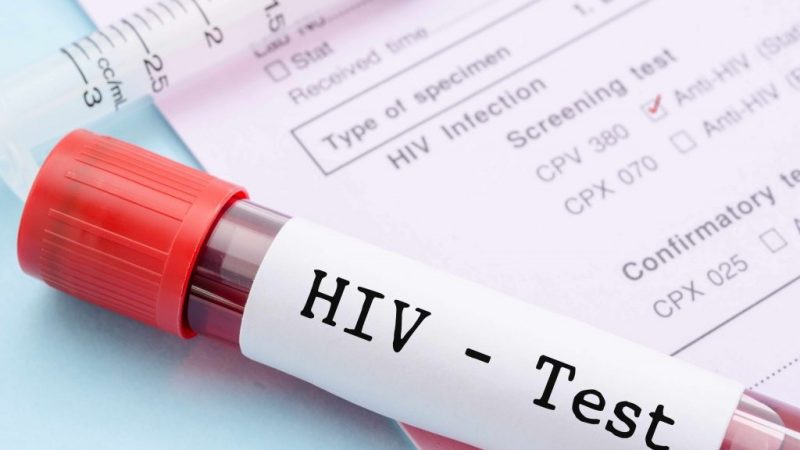 Most Essential Paths to Test for HIV