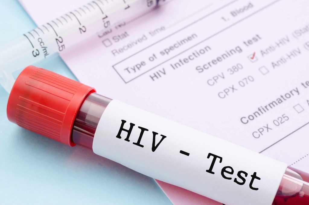 Most Essential Paths to Test for HIV