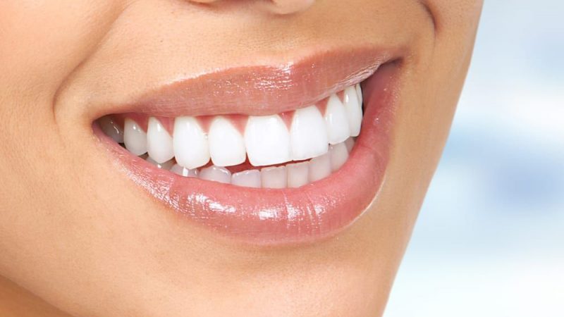 Home Remedies For Teeth Whitening