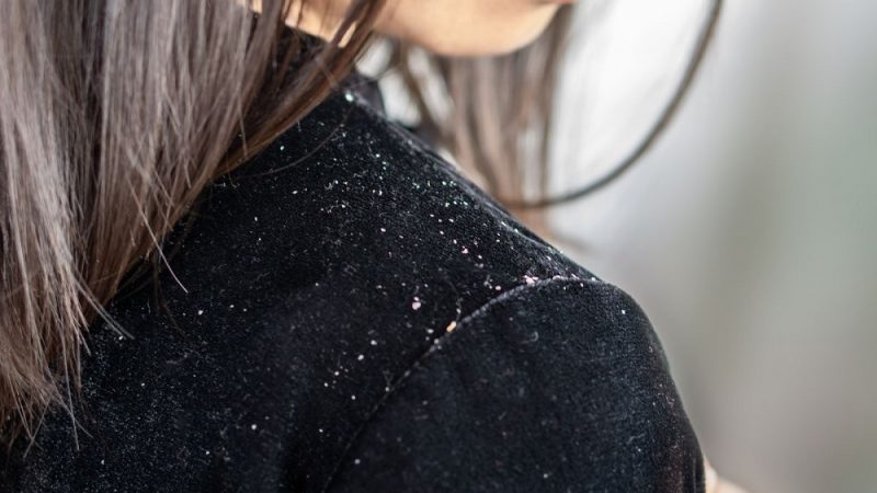 Facing Dandruff Problems? You Might Want To Change Your Shampoo!