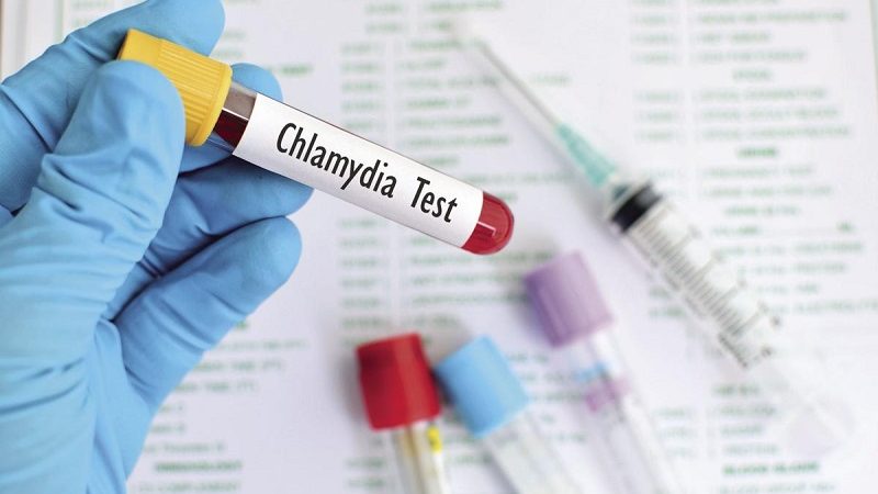 Why It’s Important to Get Tested for Chlamydia