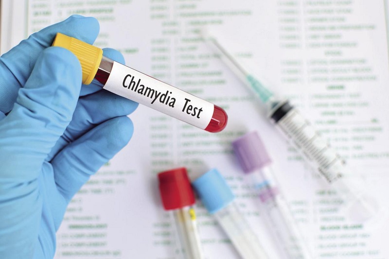 Why It’s Important to Get Tested for Chlamydia