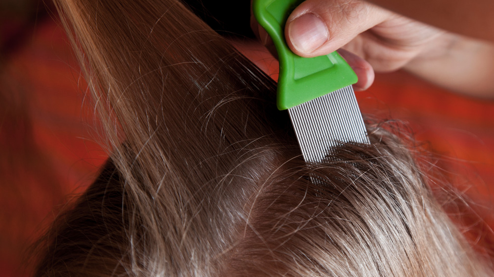 What’s the Therapy for Lice in San Antonio?