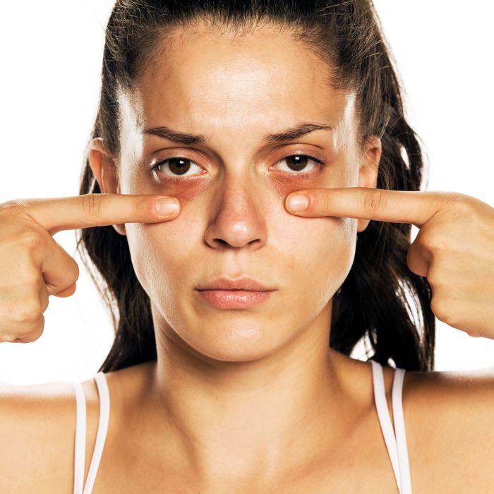 Effective Treatments For Eyebags Removal