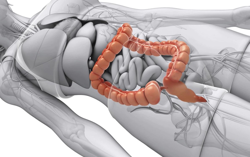How The Long Island Colon Surgeons Perform Colectomy?
