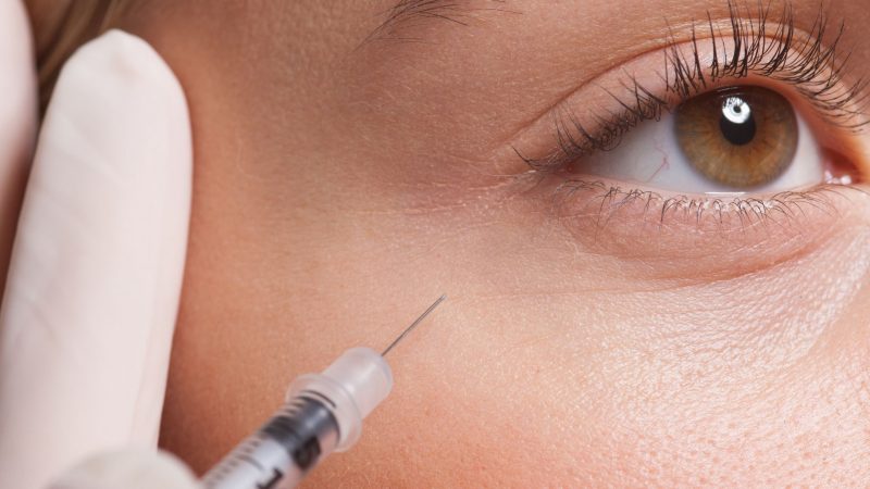 Planning to Take Botulinum Toxin (Botox) Injection – Know How It Works?