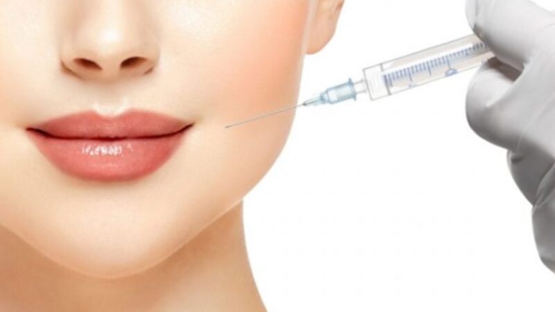Things You Need to Know About Dermal Fillers