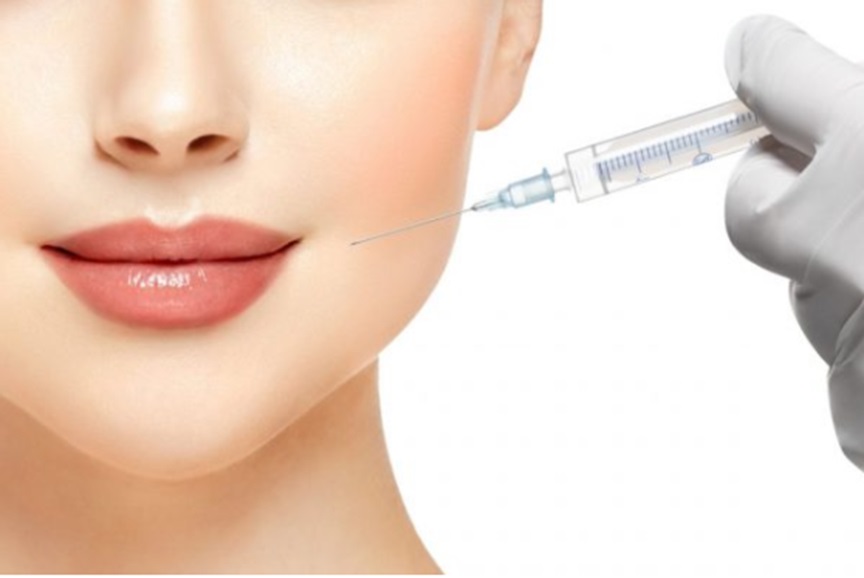 Things You Need to Know About Dermal Fillers