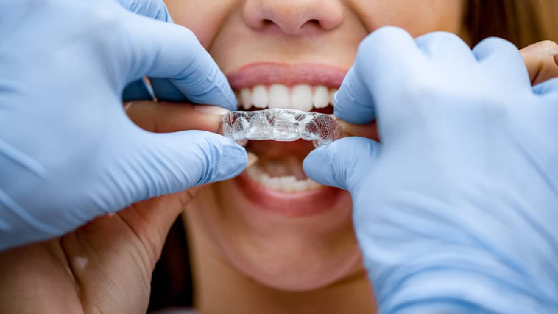 How To Find The Right Invisalign Provider