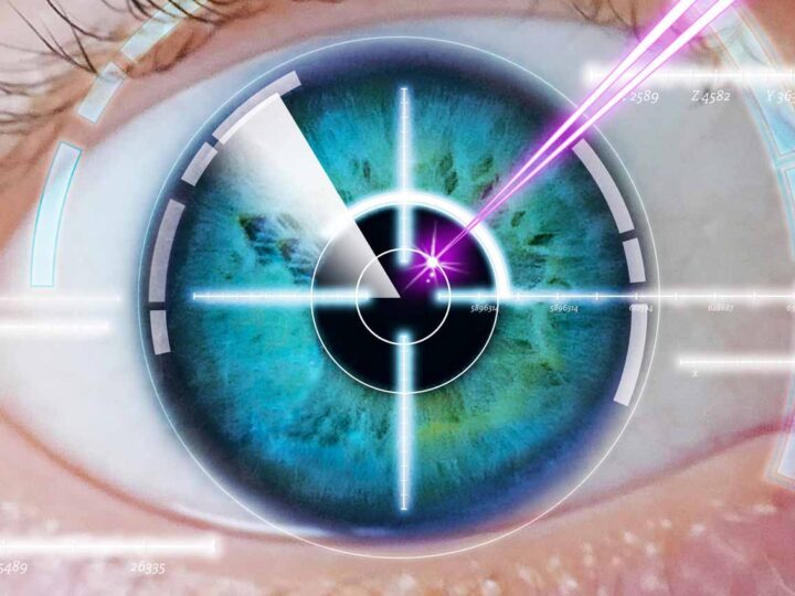 LASIK Eye Surgery: Procedure, Benefits and Risks