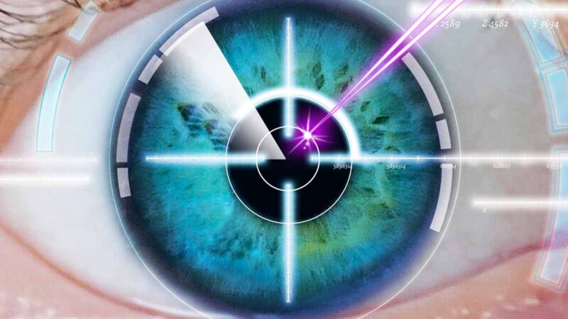 LASIK Eye Surgery: Procedure, Benefits and Risks