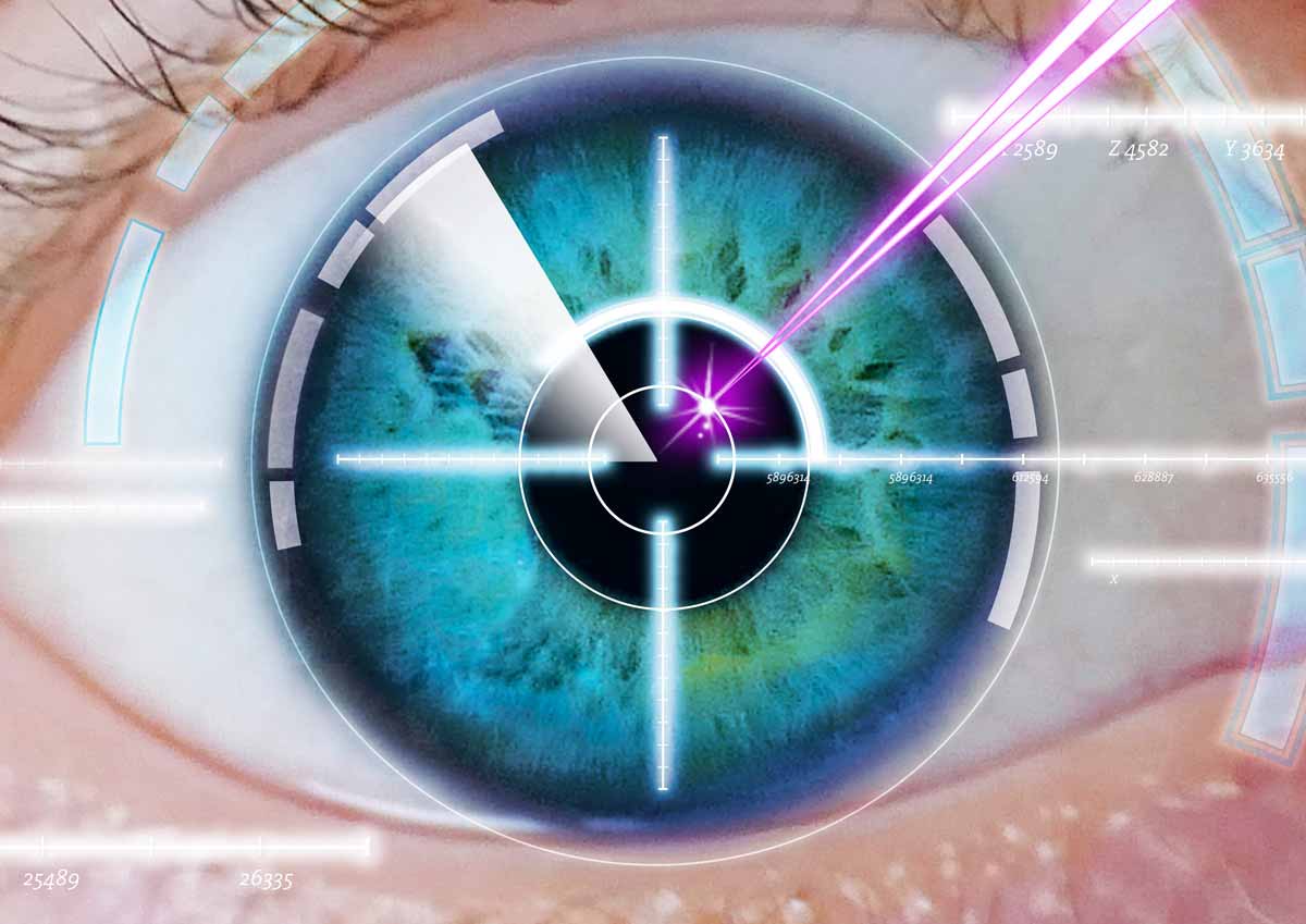 LASIK Eye Surgery: Procedure, Benefits and Risks