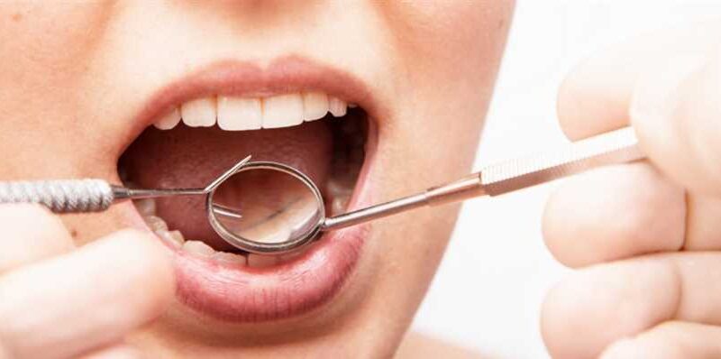 Five Natural Remedies to Keep Gums Healthy