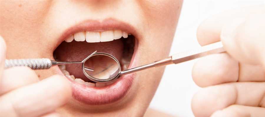 Five Natural Remedies to Keep Gums Healthy