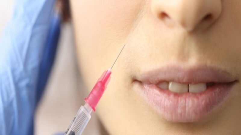 Top 5 Benefits of Micro-needling with PRP