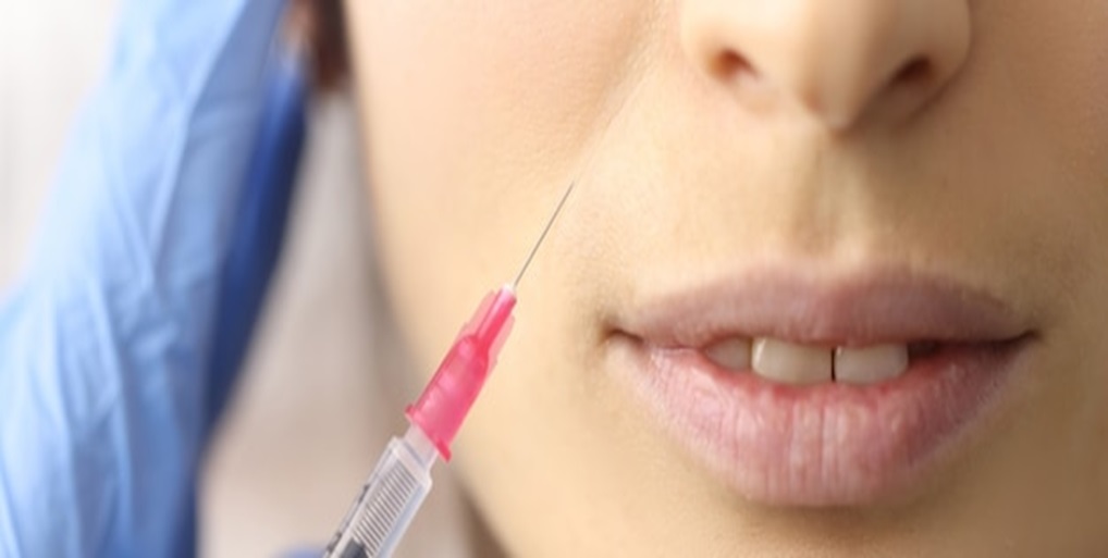 Top 5 Benefits of Micro-needling with PRP