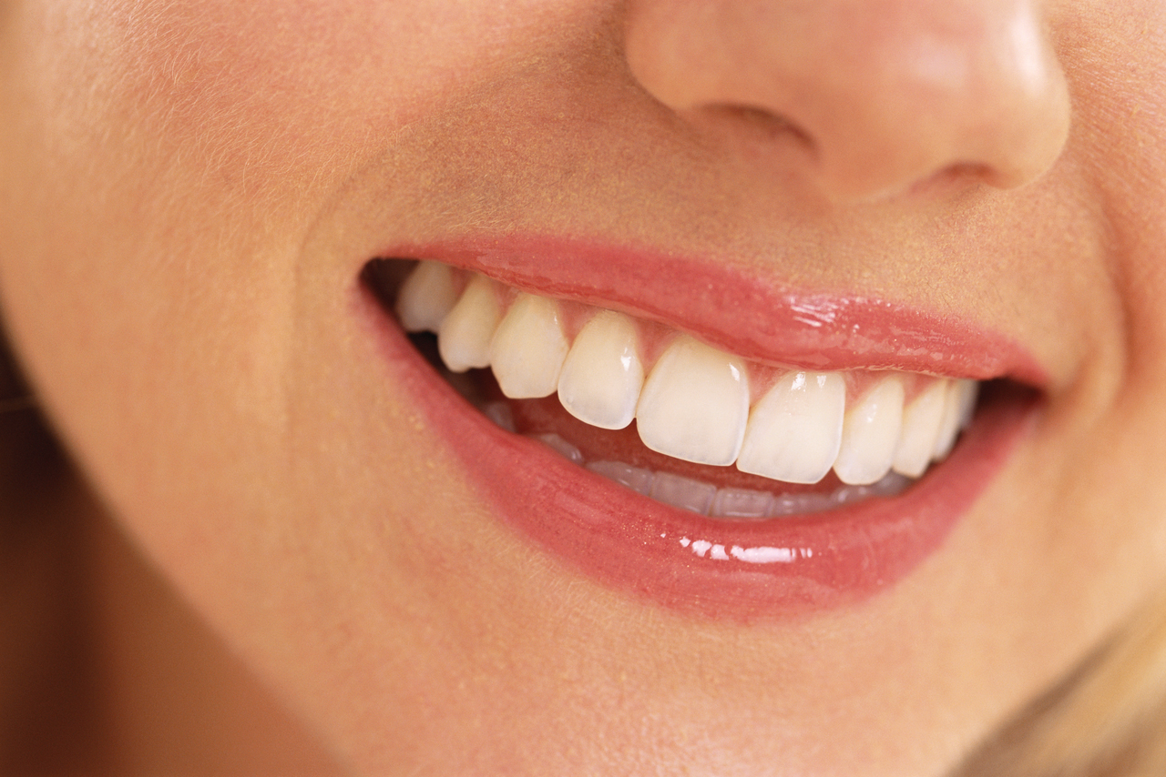 Smile Makeover: The Most Popular Procedures