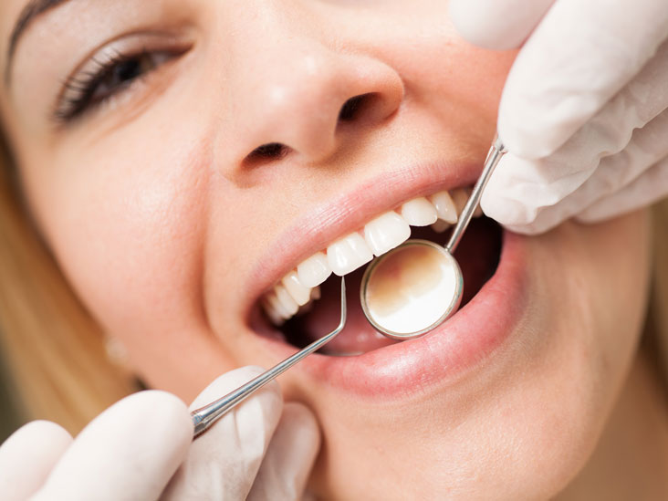 What Happens During Dental Cleanings?