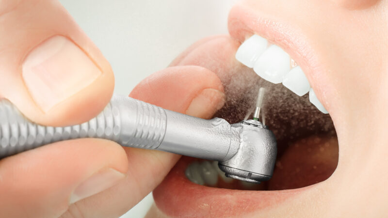 4 Restorative Dentistry Top Advantages