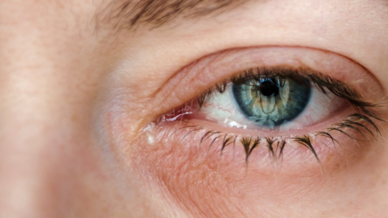Are You Aware of These Risk Factors for Macular Degeneration?