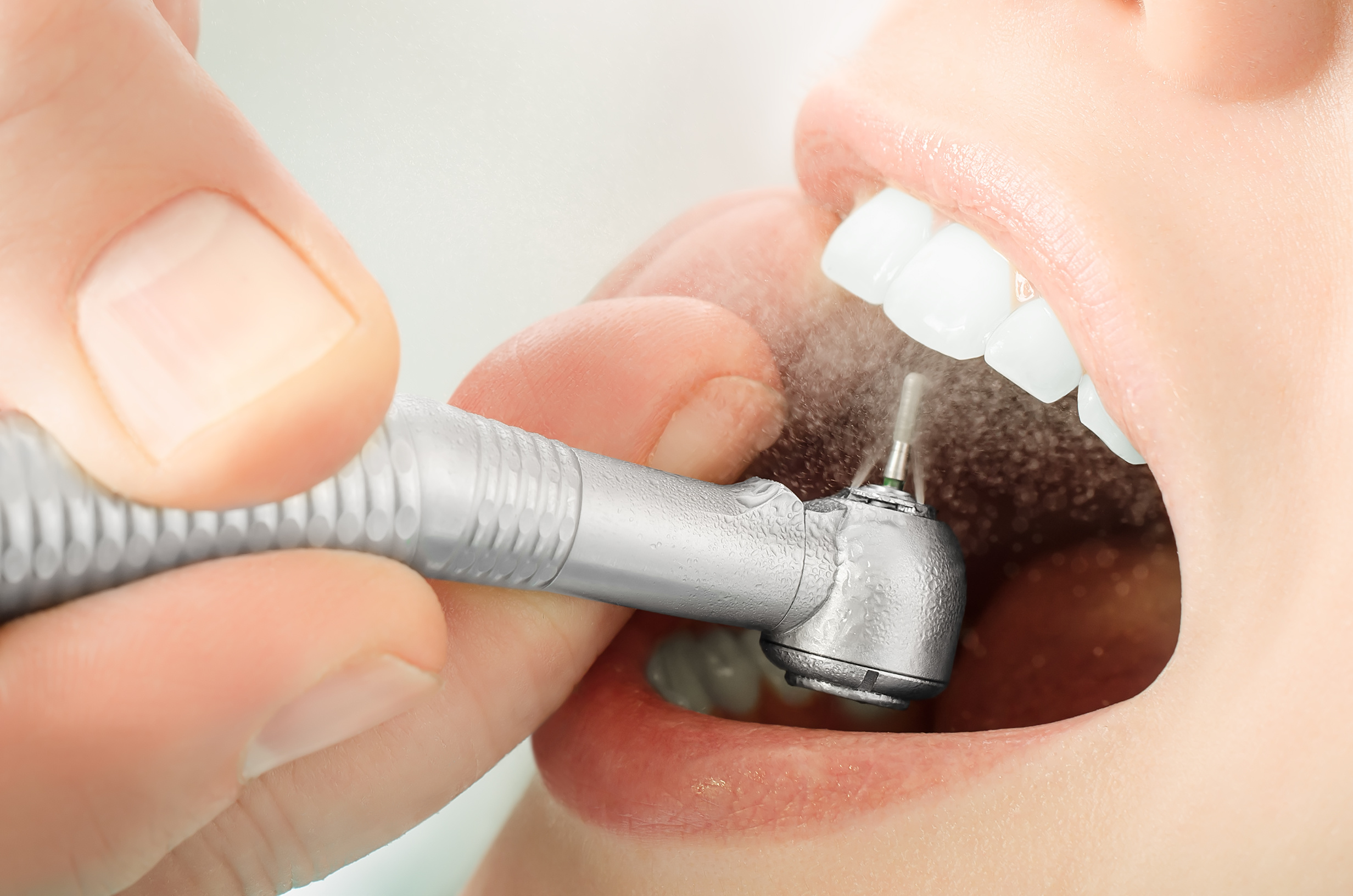 4 Restorative Dentistry Top Advantages