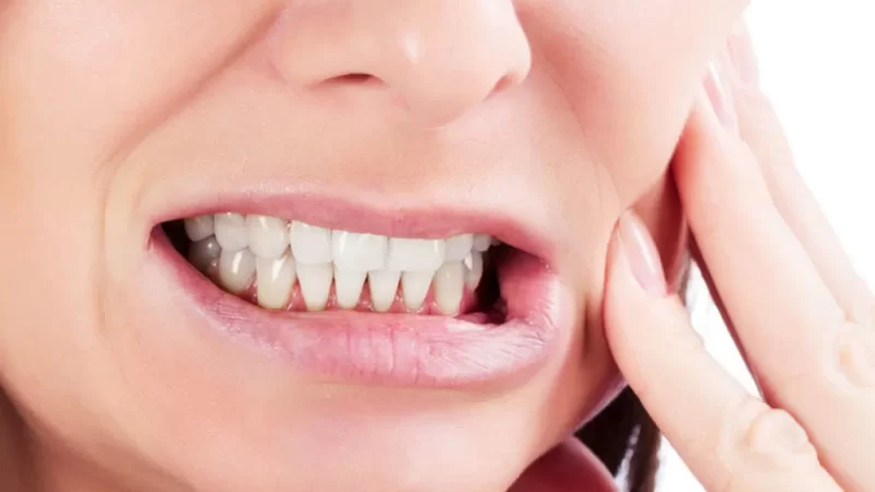 Bruxism: Causes, Types, and Treatment Options