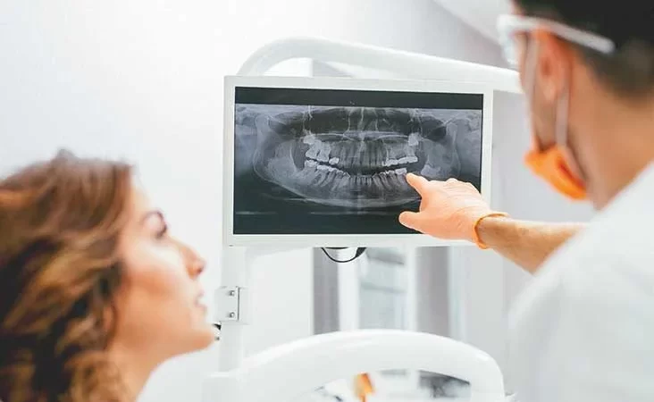 What are Dental X-Rays Used for?