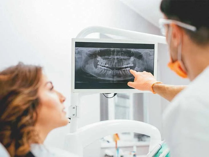 What are Dental X-Rays Used for?