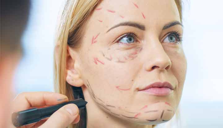 How to Prepare for a Facelift
