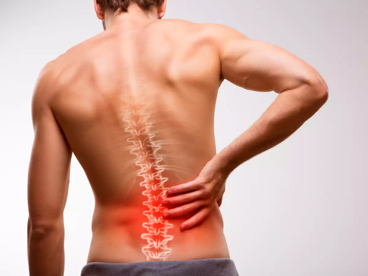 Common Myths about Spondylitis