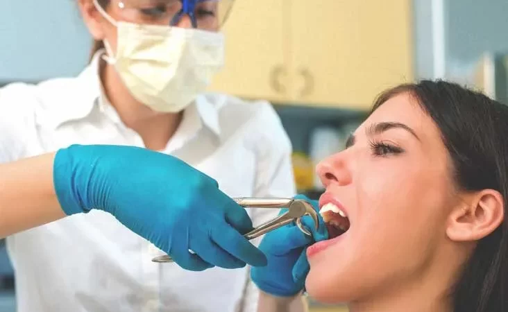 Advantages of Tooth Extraction by a Specialist