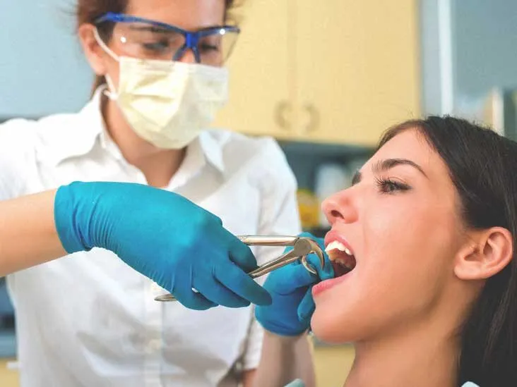 Advantages of Tooth Extraction by a Specialist