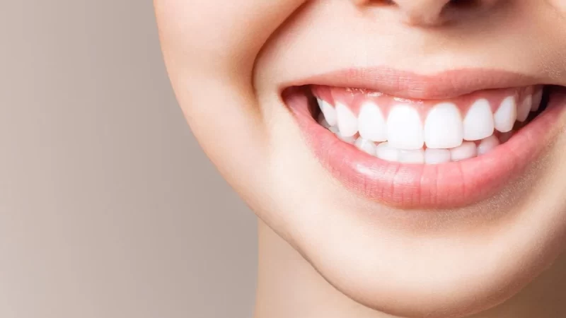 Achieve Your Smile Goals With Teeth Whitening