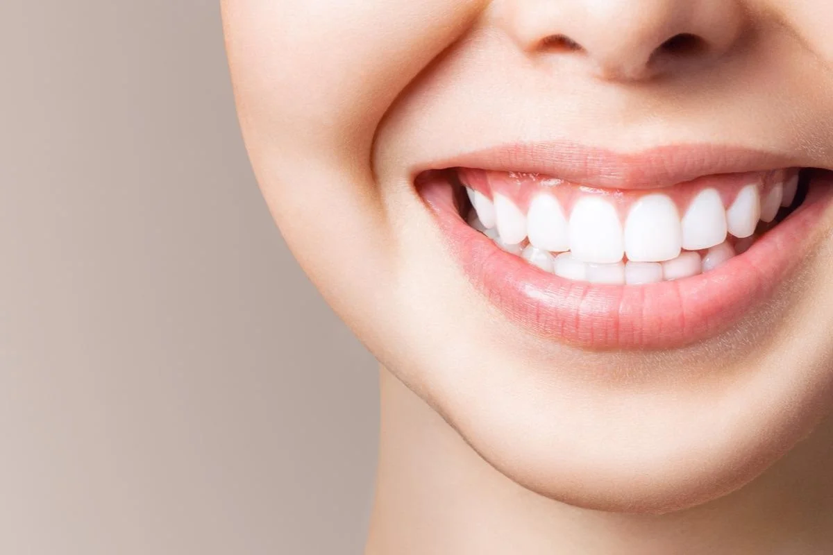 Achieve Your Smile Goals With Teeth Whitening