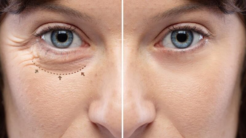 Conditions Treated by Oculofacial Plastic Surgeons