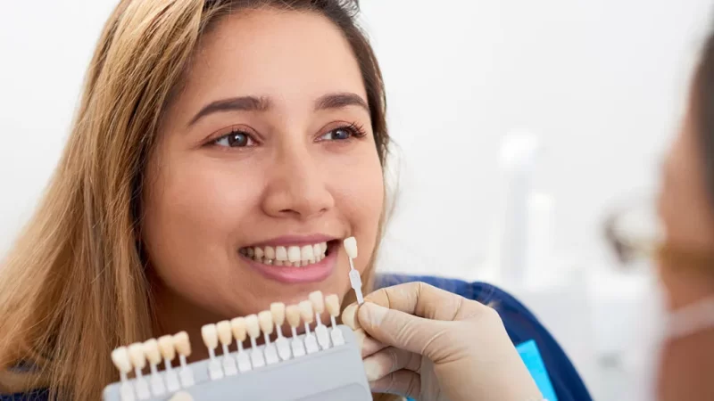 Effective Ways To Take Care Of Your Veneers