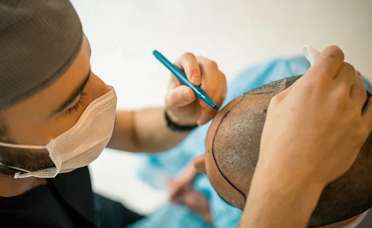 Five Hair Loss Signs that Should Prompt You to Seek Assistance From a Hair Restoration Center