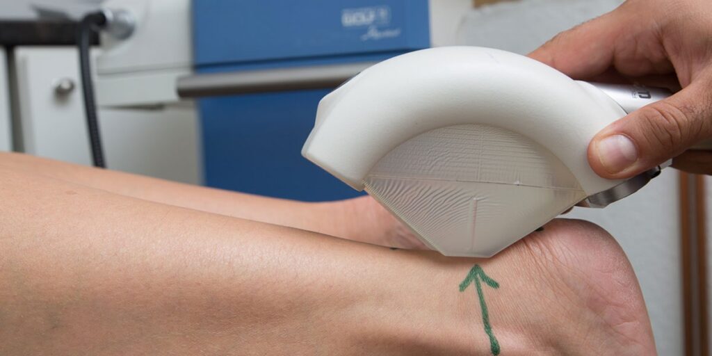 A Clear Set of Differences About acoustic wave therapy and shockwave therapy differences therapy differences