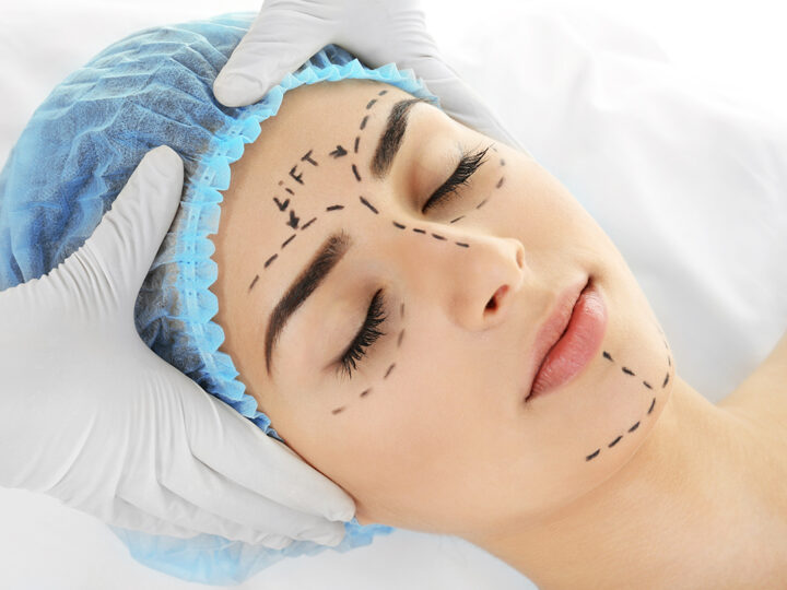 The Benefits and Risks of Plastic Surgery