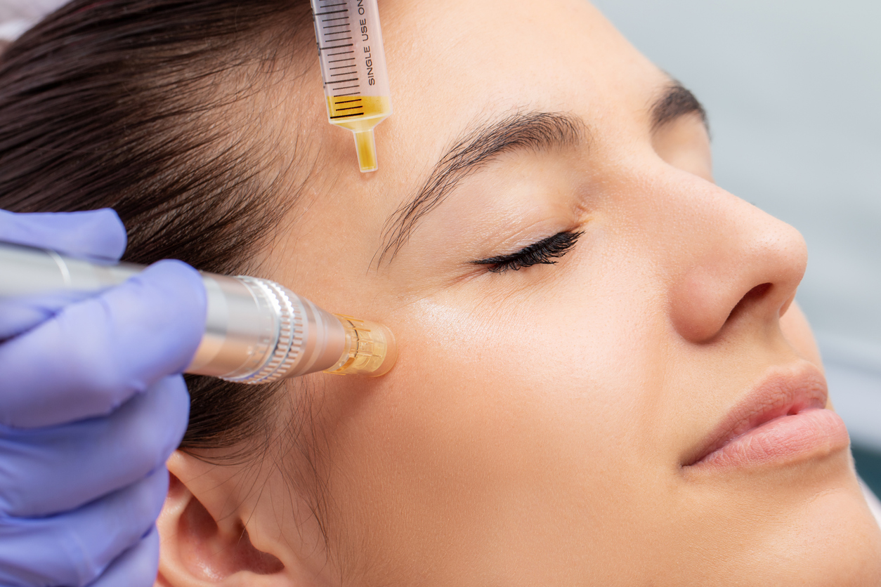 Amazing Benefits of PRP Facials You Need to Know About