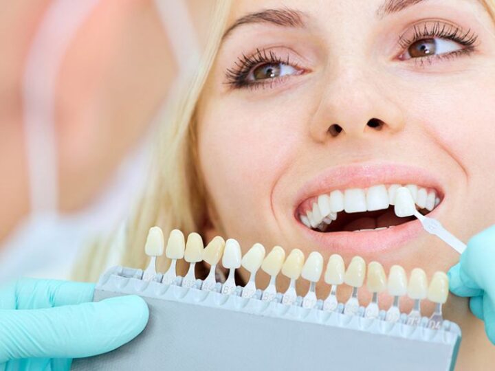 How to Choose the Right Cosmetic Dentist for You