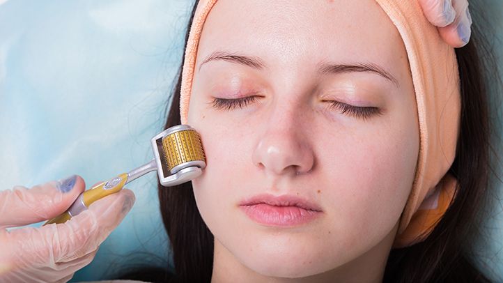 Reasons Why Microneedling is Helpful for Your Skin