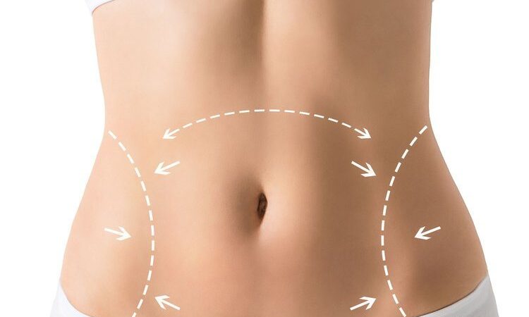 Tummy Tuck Services In Englewood: 3 Things To Know 