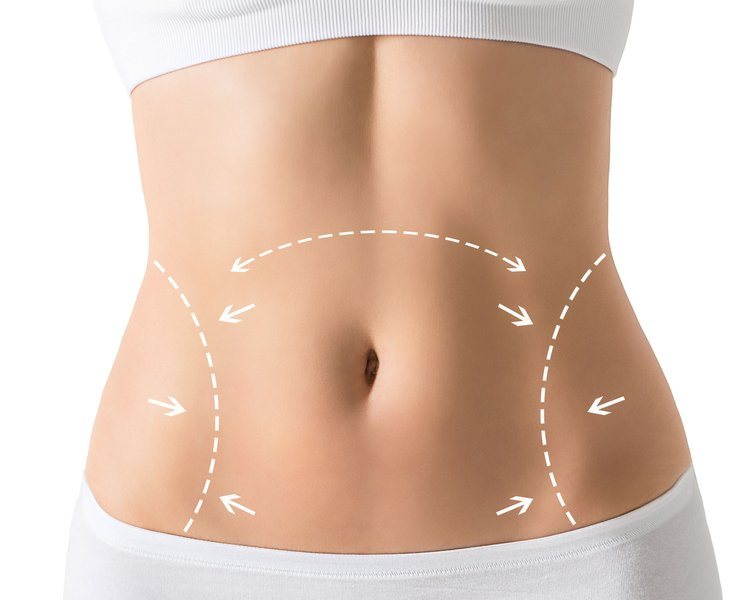 Tummy Tuck Services In Englewood: 3 Things To Know 