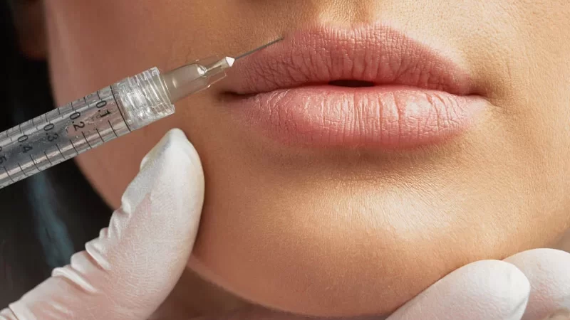 What Do You Need To Know About Botox?