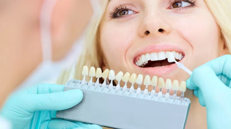 Teeth Whitening: How Teeth Whitening Can Transform Your Smile? 