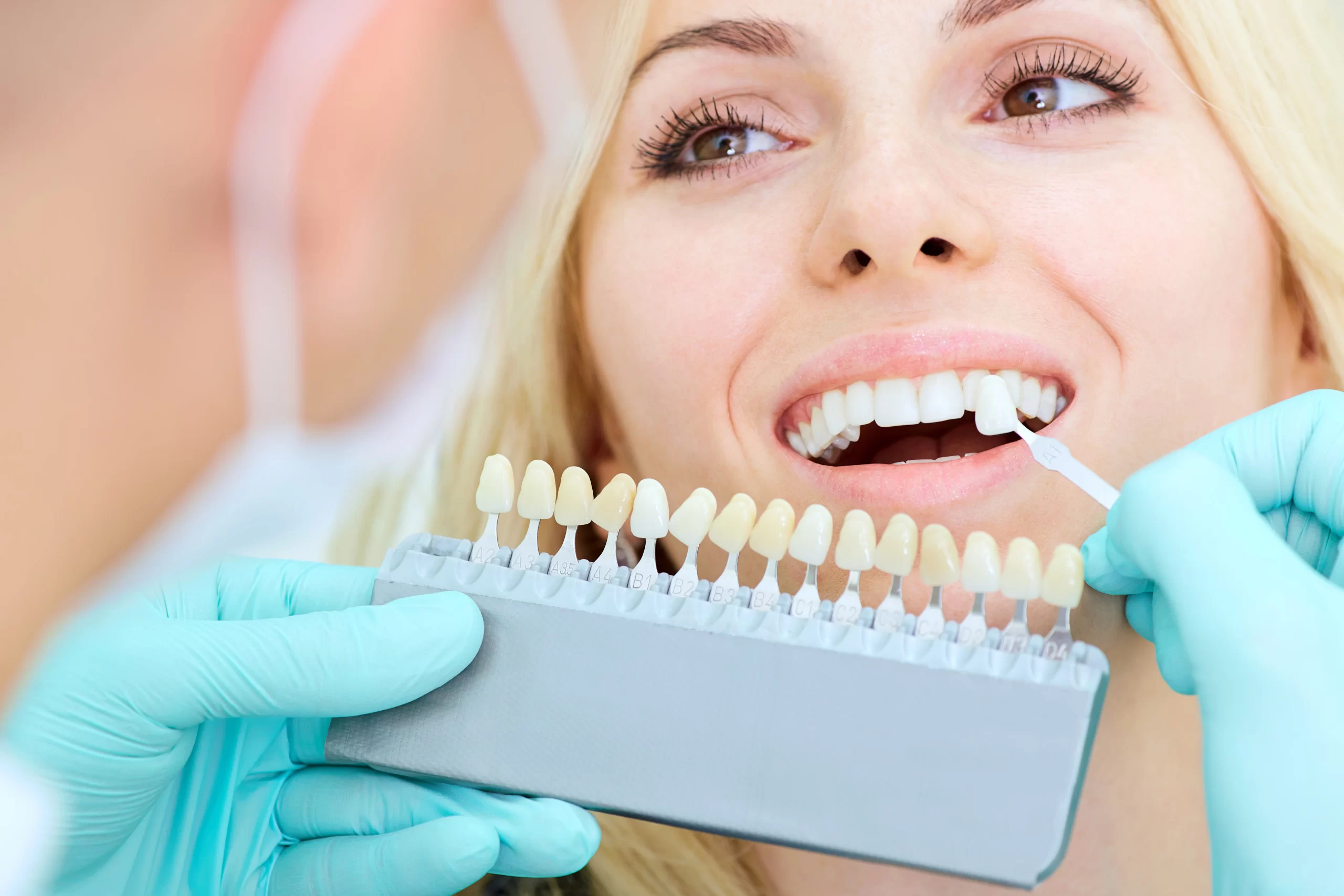 Teeth Whitening: How Teeth Whitening Can Transform Your Smile?
