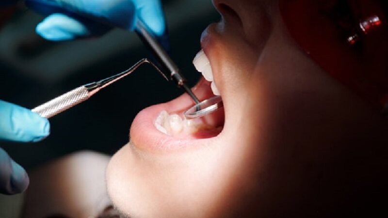 Preventing dental health complications by visiting your dentist Gordon