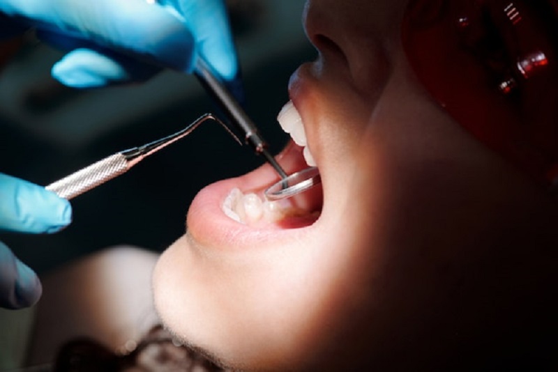 Preventing dental health complications by visiting your dentist Gordon