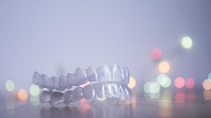 FAQs about at-home dental aligners answered